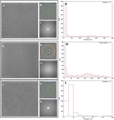 Benchmarking cryo-EM Single Particle Analysis Workflow